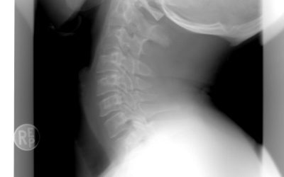 Bihor: AI analizează radiologiile, medicul validează