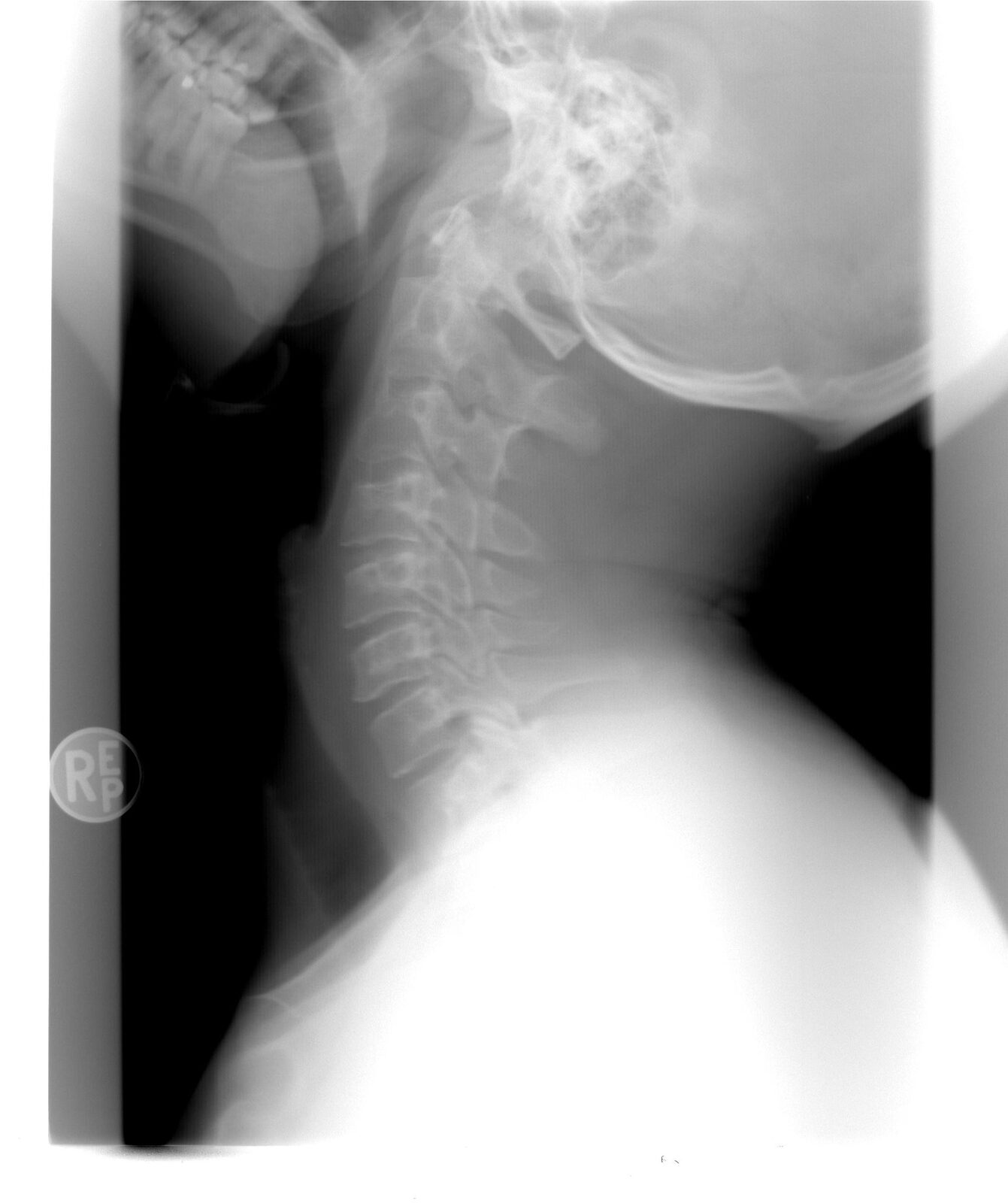 Bihor: AI analizează radiologiile, medicul validează