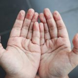 Pielea ca de strugure: De ce se încrețește în apă