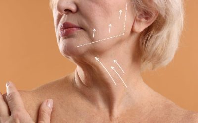 Când gâtul cere bisturiu, nu doar cremă: Liftingul cervical