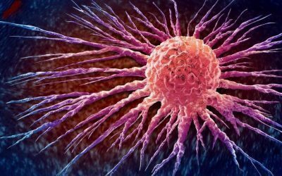 Tratament personalizat anti-cancer, unic pentru fiecare tumoră