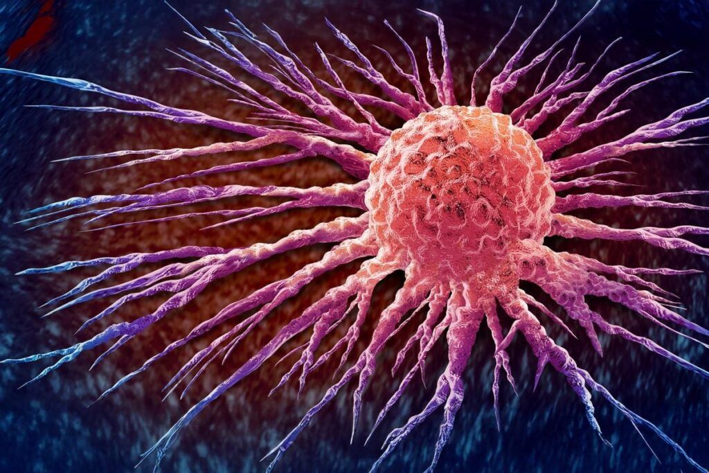 Tratament personalizat anti-cancer, unic pentru fiecare tumoră