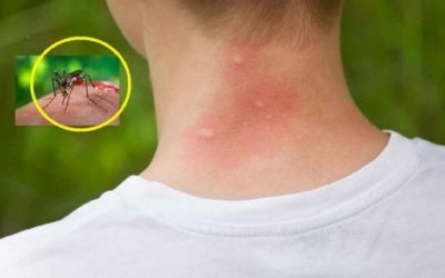 Țânțarii te mușcă mai des? Trei bacterii cheia misterului