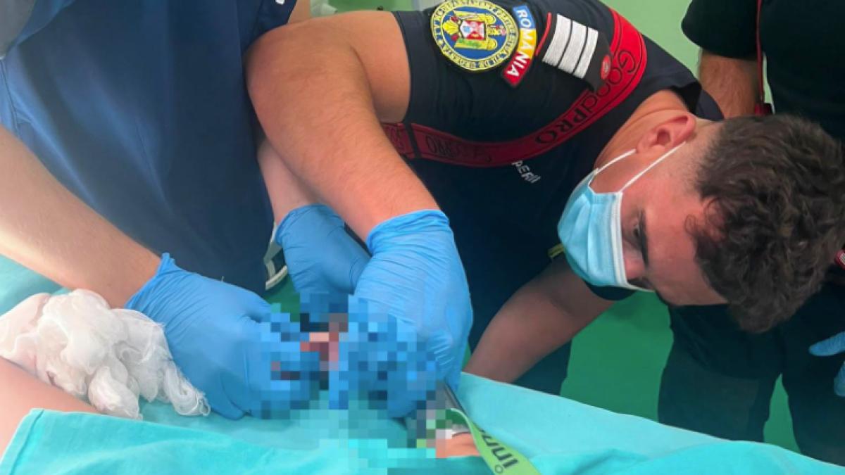 Copil de 2 ani, mâna prinsă în tocător. Pompieri în sala de operație