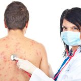 Vaccin Zona Zoster: Risc Mai Mic de Demență, Arată Cercetătorii