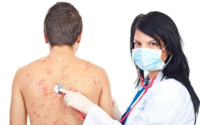 Vaccin Zona Zoster: Risc Mai Mic de Demență, Arată Cercetătorii
