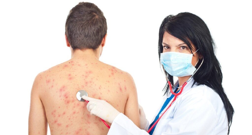 Vaccin Zona Zoster: Risc Mai Mic de Demență, Arată Cercetătorii