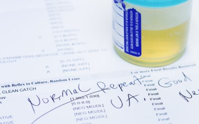 Test simplu: Depistează 9 din 10 cancere de vezică
