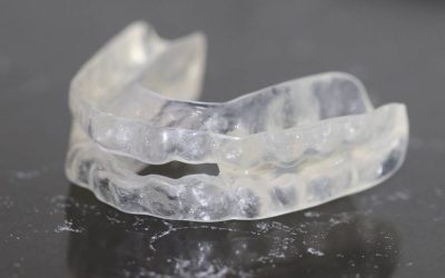 Aparat dentar invizibil la adult: Ghidul complet și sfaturi esențiale