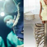 Talie subțire cu coaste rupte: Experții trag semnalul de alarmă