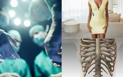 Talie subțire cu coaste rupte: Experții trag semnalul de alarmă