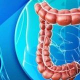Tratament miraculos: Dispare cancerul rectal la 49 pacienți