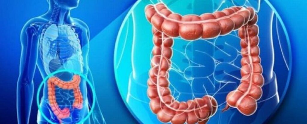 Tratament miraculos: Dispare cancerul rectal la 49 pacienți